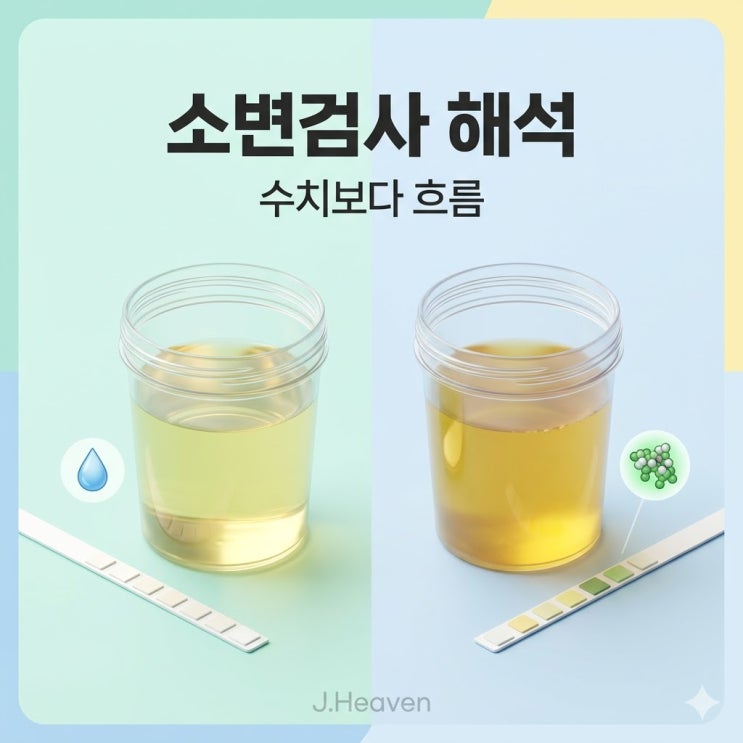소변검사, 단백뇨 1+는 위험할까요? — 흐름으로 보는 임상 판단 기준 : 네이버 블로그