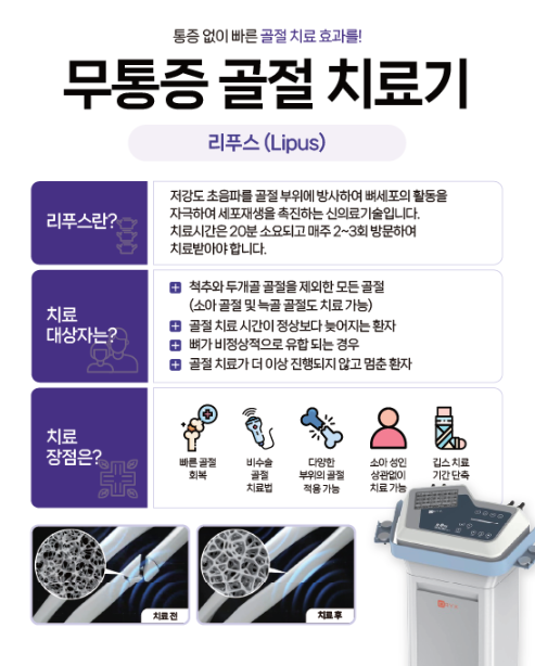 걸포바른정형외과 골절치료기 리푸스(LIPUS) 도입 : 네이버 블로그