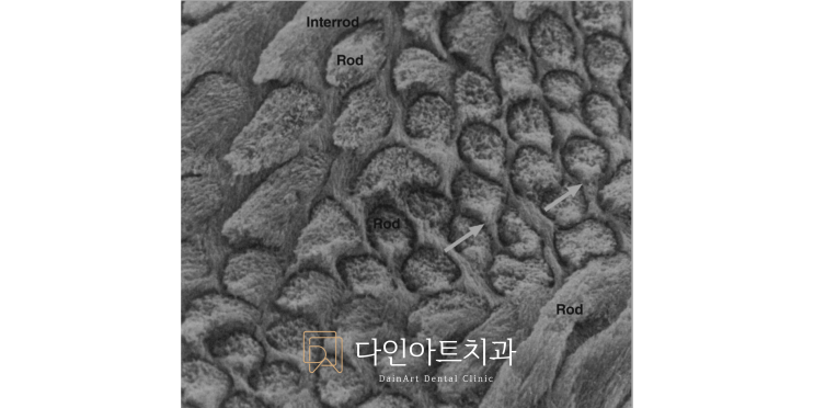 Biomimetic Dentistry 이야기: Part 2. 자연 치아의 구조를 이해하자