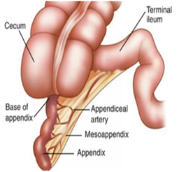 Laparo appendectomy : 네이버 블로그