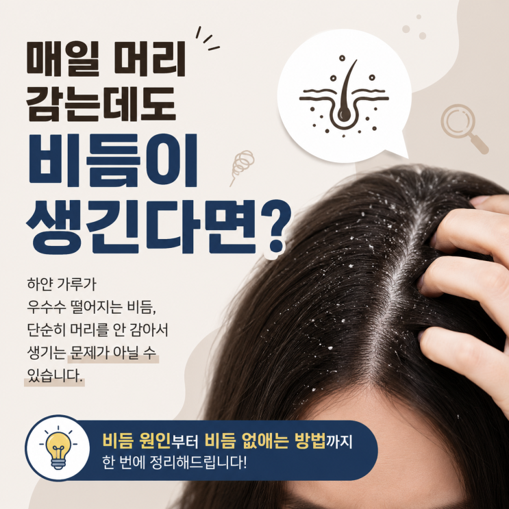매일 머리 감는데도 비듬이 생기는 이유, 비듬 원인과 비듬 없애는 방법