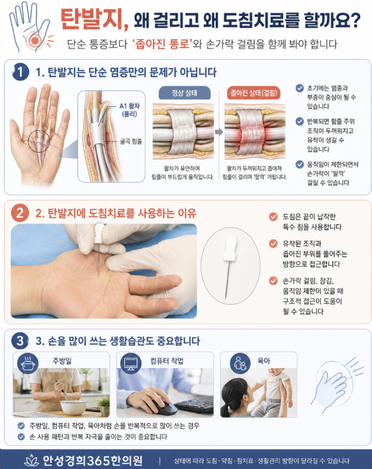 아침마다 손가락이 안 펴진다면, 탄발지 원인과 도침치료