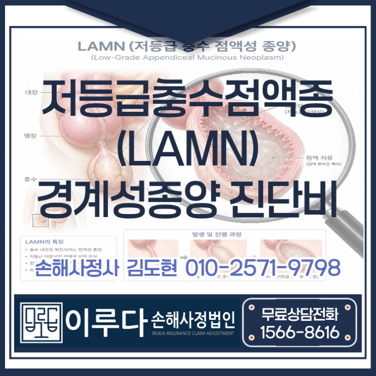 LAMN 저등급 충수 점액성 신생물, 양성 코드로 거절됐지만 경계성종양 인정받은 사례 : 네이버 블로그