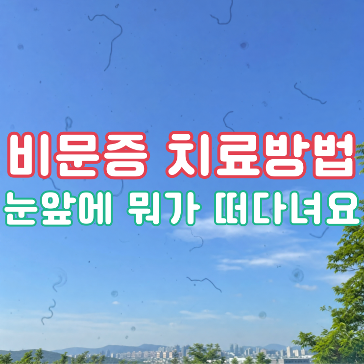 비문증 치료방법, 눈앞에 뭐가 떠다닌다면 꼭 보세요