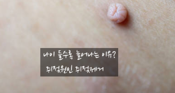 나이와 연령 변화 관련 이미지