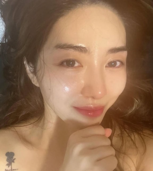 권민아, 슈링크 의료사고 4개월째 흉터 "1억 손해…합의 제안했다가 협박범으로 몰려"