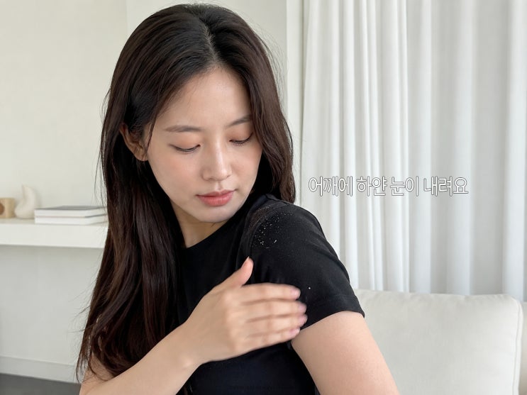 머리 비듬 없애는법 두피 각질 원인, 샴푸 방법까지