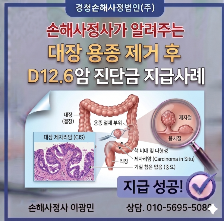 대장 용종 제거 후 D12.6 보험금, 지급 가능성과 핵심 검토 기준 : 네이버 블로그