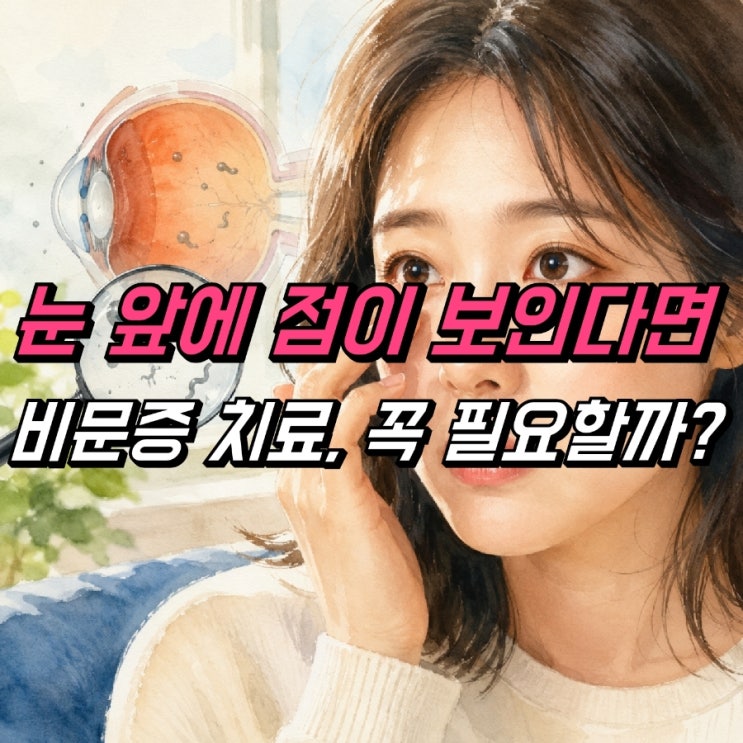 비문증 원인 증상, 비문증치료 꼭 필요할까