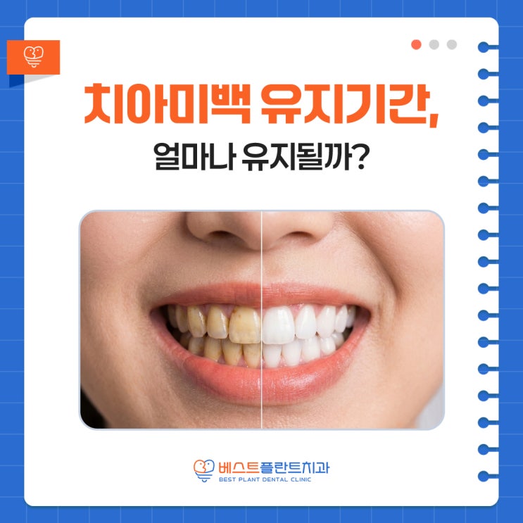 창원중앙동치과가 알려주는 치아미백 유지 기간과 관리 꿀팁