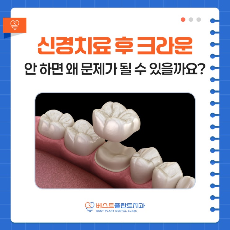 창원상남치과 신경치료 후 크라운 안 하면 왜 문제가 될 수 있을까요?