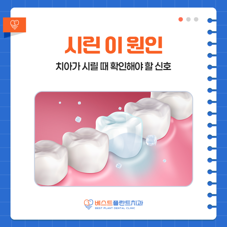 창원성산구치과 시린 이 원인 총정리, 치아가 시릴 때 확인해야 할 신호