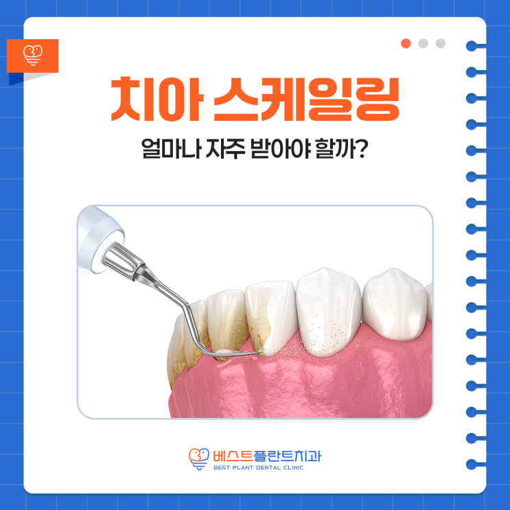 용지동치과 치아 스케일링 주기, 얼마나 자주 받아야 할까?
