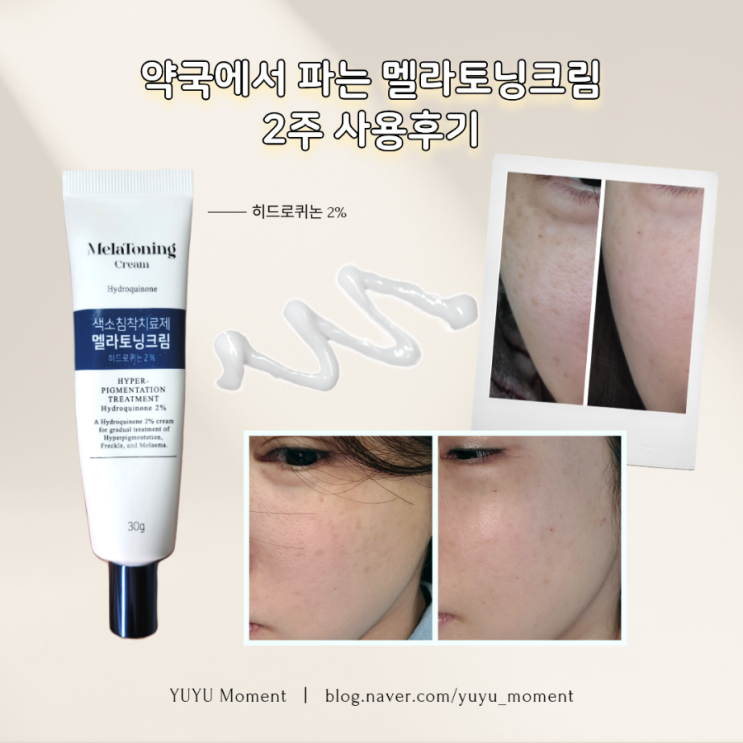 [리뷰] 멜라토닝크림 2주사용 경과후기(기미/주근깨/색소침착)