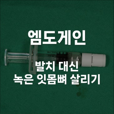 엠도게인, 발치 대신 녹은 잇몸뼈 살리기
