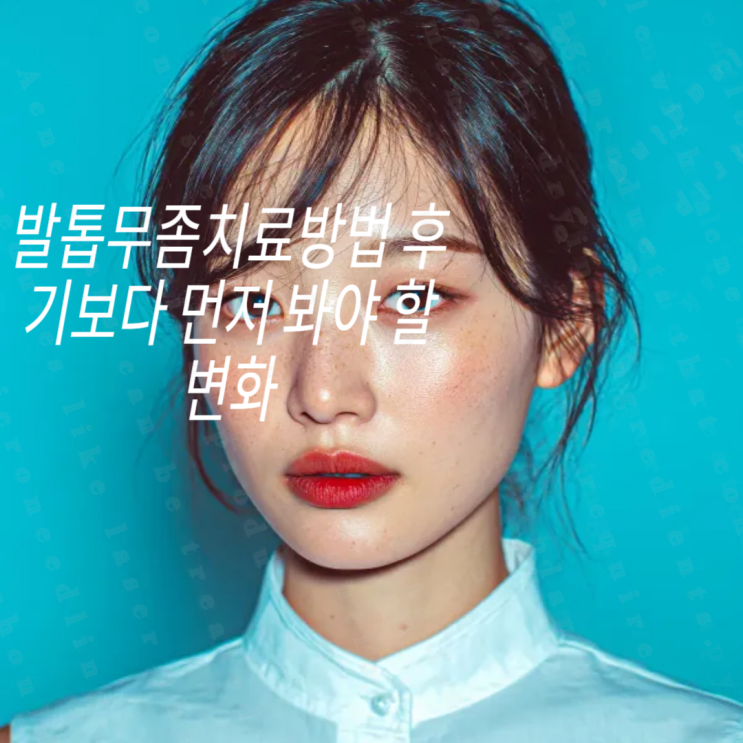 발톱무좀치료방법 후기보다 먼저 봐야 할 변화