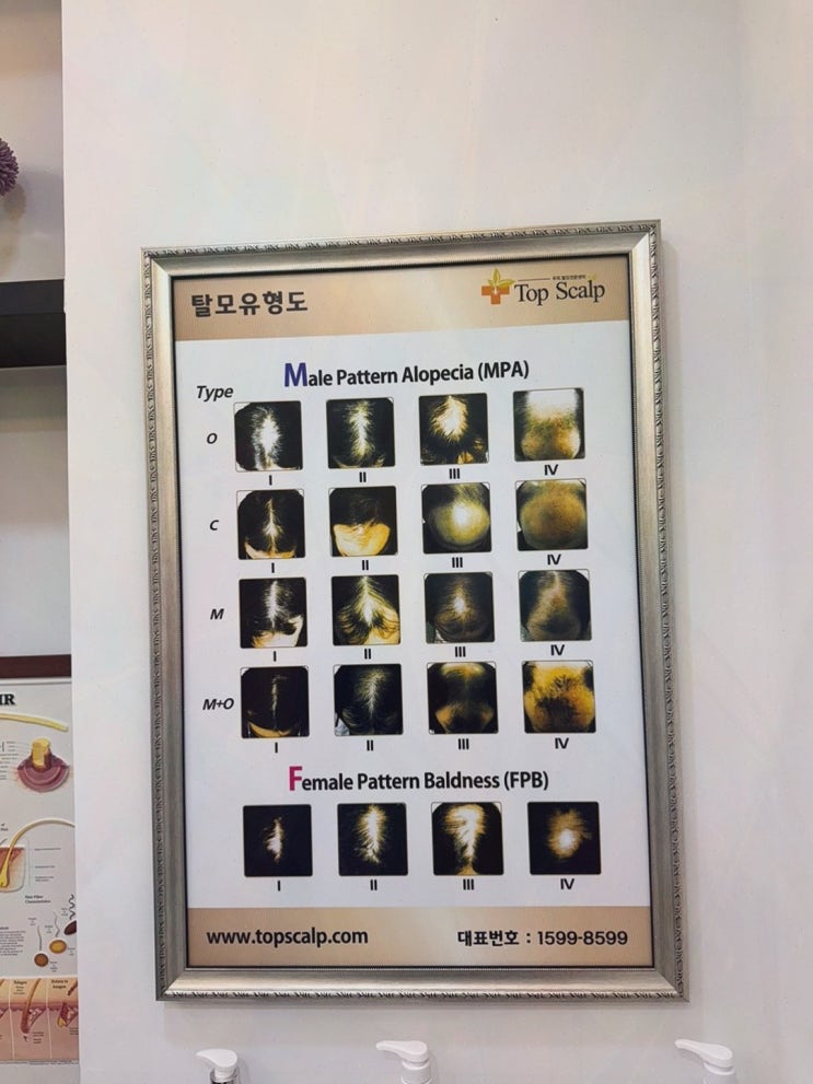 동탄두피관리, 거울에 멈칫했을 때 탑스칼프 동탄점