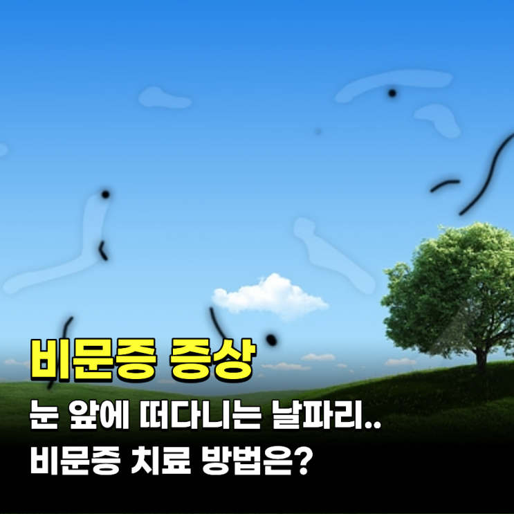 비문증 증상 눈 앞의 날파리.. 비문증 치료 방법은?