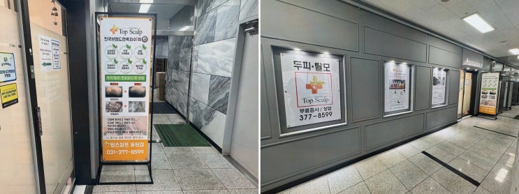 동탄두피관리 탑스칼프 동탄점, 정찰가격제와 1:1 맞춤 케어
