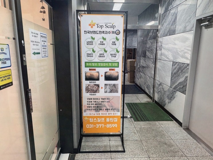 동탄탈모 탑스칼프 동탄점, 정찰가격과 1:1 맞춤 케어