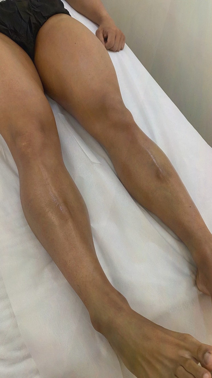 시흥슈가링왁싱 모적감각 브라질리언 첫경험, 안 아프게 끝낸 원장