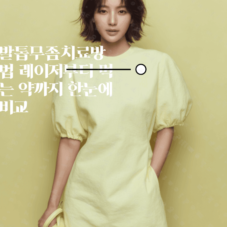 발톱무좀치료방법 레이저부터 먹는 약까지 한눈에 비교