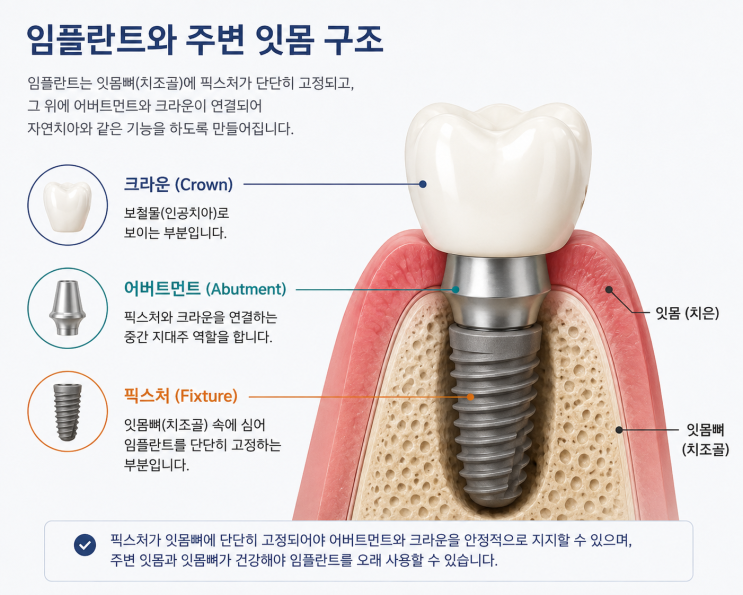 의정부치과 임플란트 주위염, 주변에서 피가 난다면 확인해야 할 점