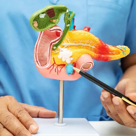 췌장 검사 방법 알아보기, (CT, MRI 검사 차이점)