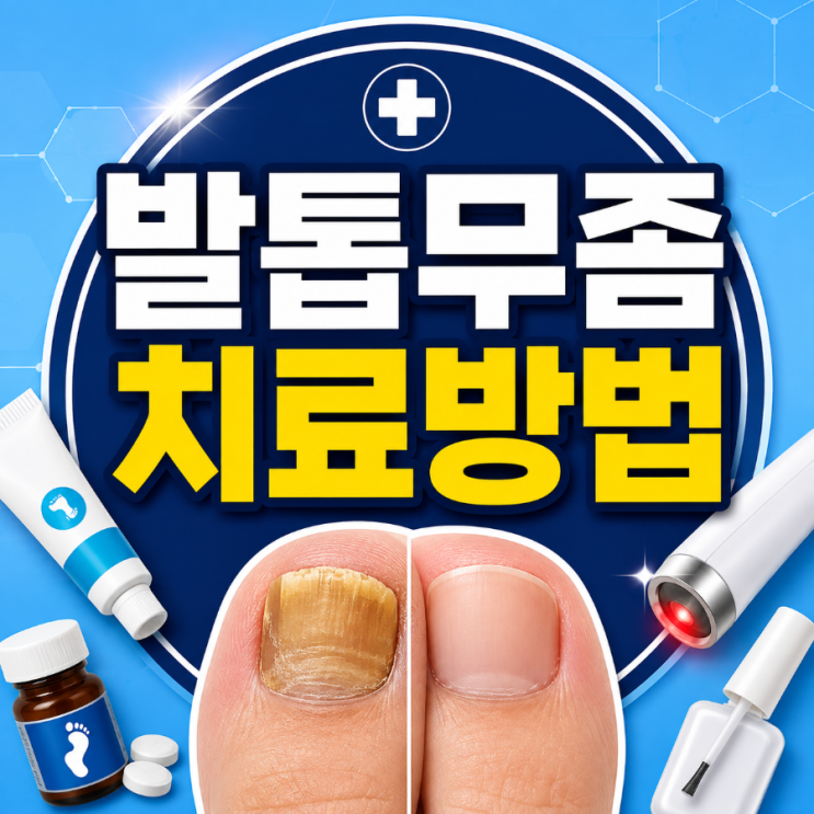 발톱무좀 치료방법, 약으로 안 낫는다면 이렇게 치료합니다