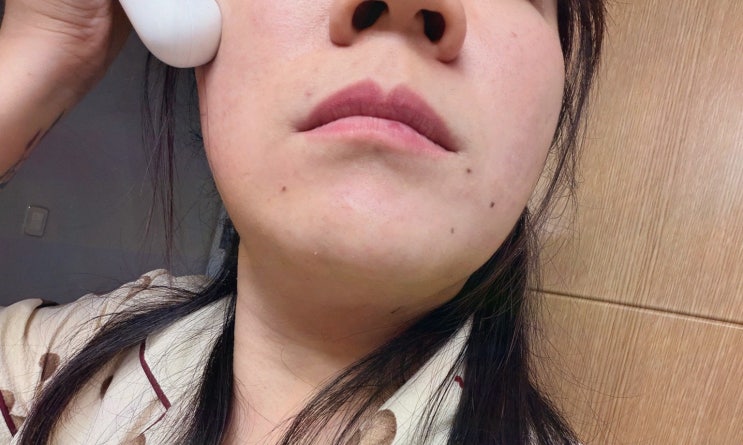 HIFU디바이스 360°회전 홈쎄라 타잇티 TITY 1DOT, 전신 밀착 케어