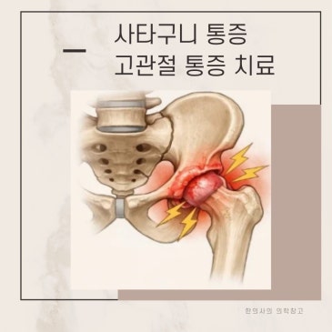 러닝 고관절 사타구니 통증 치료