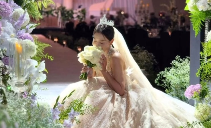 12kg 뺐는데 팔만 그대로…김하영이 결혼 1주년에 칼을 든 진짜 이유
