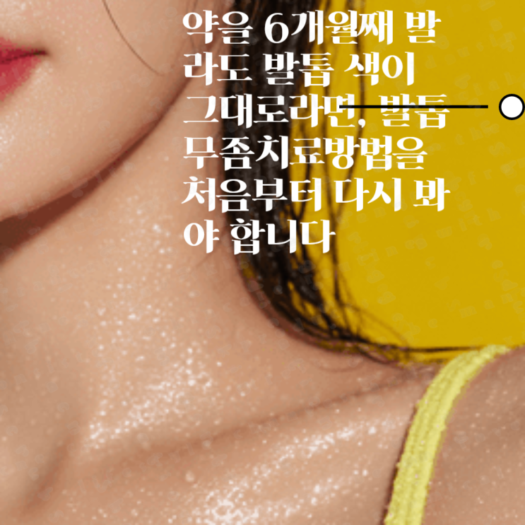 약을 6개월째 발라도 발톱 색이 그대로라면, 발톱무좀치료방법을 처음부터 다시 봐야 합니다