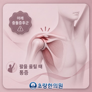 부산동구 초량 충돌증후군 어깨에서 들리는 소리