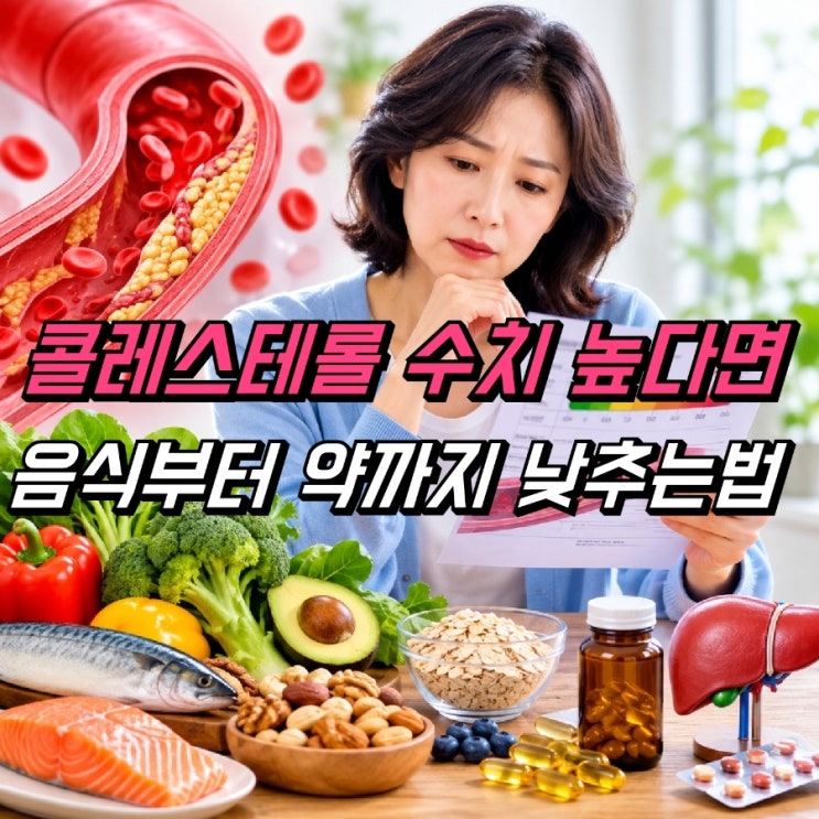 콜레스테롤 수치 높은 이유, 낮추는 방법 음식 영양제 약