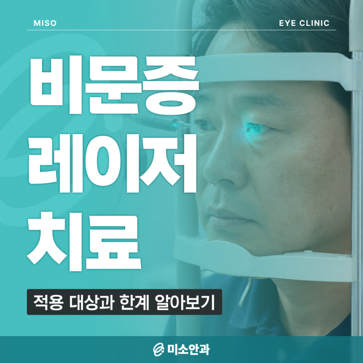 비문증레이저치료 효과 있을까? 적용 대상과 한계 알아보기