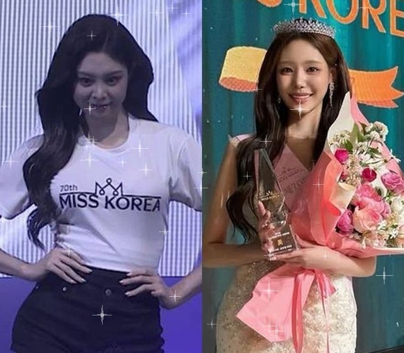 미스코리아 진, 생일에 성형 의혹 폭탄…축하한 사람이 하필 '탈락....