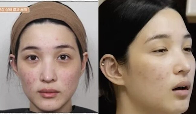 "20대 맞아?" 율희 쌩얼에 난리 난 진짜 이유…누리꾼들이 꽂힌 건 피....