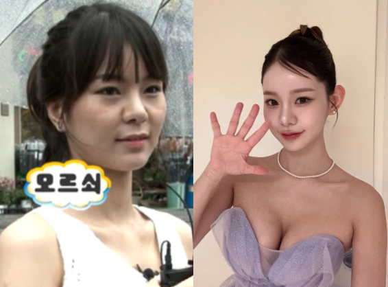 맹승지 연애전쟁 거절, 의사 남친과의 관계는 비즈니스가 아니었습....