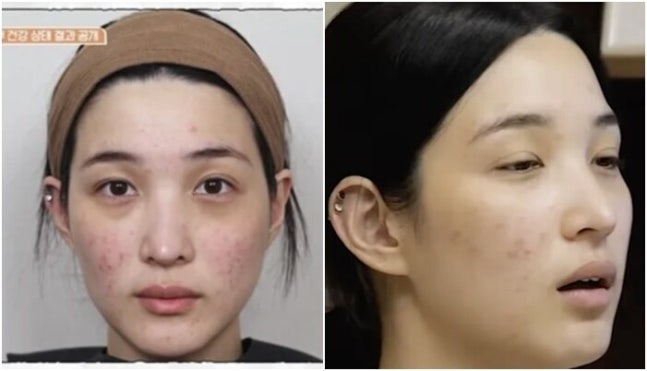 율희 민낯 상태 공개 걸그룹 비주얼 어디로~출산,육아 후 망가진 피....
