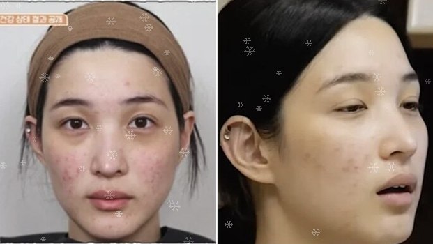 "애들은 전남편이 키우는데?" 율희 피부 고백에 불붙은 여론…쿨하....