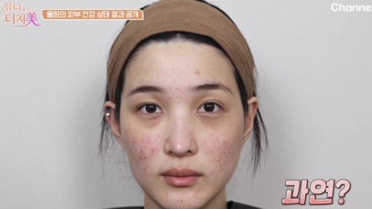29세 율희 피부가 무너진 이유…매일 ‘30분씩’ 한 이것이 문제였다