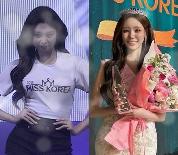 미스코리아 진 우서윤, 생일날 성형 의혹 폭풍…탈락자 전수완의 뜻....