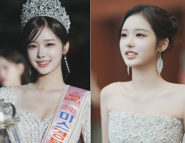 2025 미스코리아 진 정연우가 밝힌 성형 논란과 미인대회에 대한 소....
