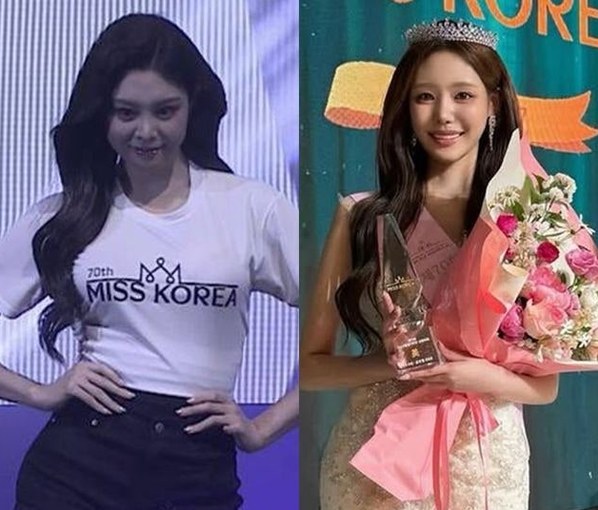 미스코리아 진 우서윤, 생일날 성형 의혹 폭풍…탈락자 전수완이 건....