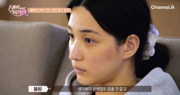 율희 피부 상태 공개 “스트레스 많아”…과도한 세안부터 안면 비....