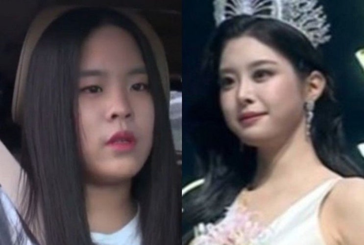 미스코리아 진 우서윤, 생일날 성형 의혹 폭풍…탈락자 전수완의 반....