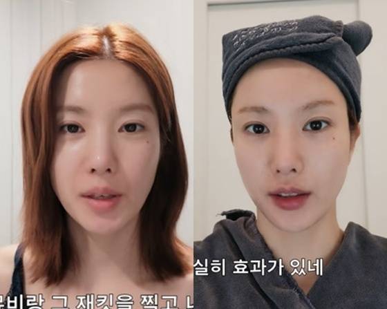 권은비 컴백전 브이로그, 식단·운동·붓기 관리부터 시술까지?