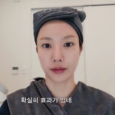 권은비가 받은 소프웨이브 레이저 리프팅시술은? 효과 비용 주의사....