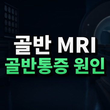 골반 통증이 오래갈 때, 골반 MRI는 어떤 질환을 확인할까요? 썸네일
